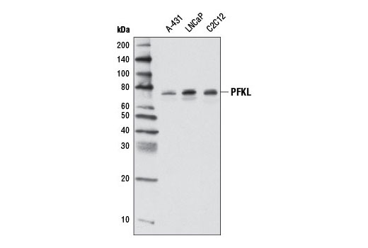 Western blot analysis of extracts from various cell lines using PFKL Antibody.