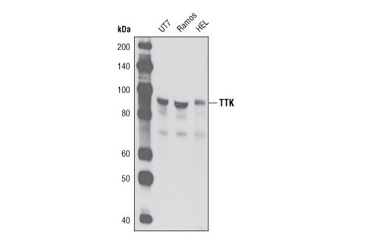 Western blot analysis of extracts from UT7, Ramos, and HEL cells using TTK (D15B7) Rabbit mAb.