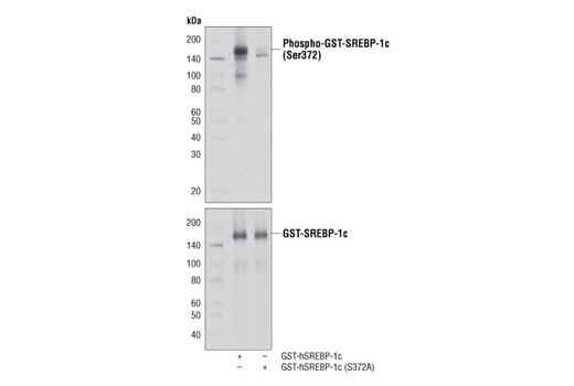 Western blot analysis of extracts from serum-starved 293T cells treated with resveratrol (50 μM, 1 hr), transfected with a GST-tagged cDNA expression construct encoding either full-length human wild-type SREBP-1c (GST-hSREBP-1c) or full-length mutant SREBP-1c (GST-hSREBP-1c (S372A)), using Phospho-SREBP-1c (Ser372) Antibody (upper) or GST (91G1) Rabbit mAb #2625 (lower). Both expression vectors were generated in Dr. Mengwei Zang's laboratory at Boston University School of Medicine.