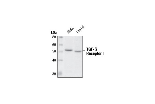 Western blot analysis of extracts from Mv 1 Lu and Hep G2 cells using TGF-β Receptor I Antibody.