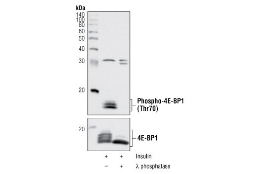 Western blot analysis of extracts from HeLa cells, serum-starved and treated with 100 nM insulin alone, or with insulin and λ phosphatase, using Phospho-4E-BP1 (Thr70) II Antibody (upper) or 4E-BP1 (53H11) Rabbit mAb #9644 (lower).