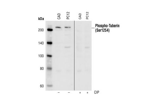 Western blot analysis of extracts from CAD and PC12 cells, using Phospho-Tuberin/TSC2 (Ser1254) Antibody. The phospho-specificity of the antibody was verified by treating the membrane with (+) or without (-) calf intestinal phosphatase (CIP) after Western transfer.