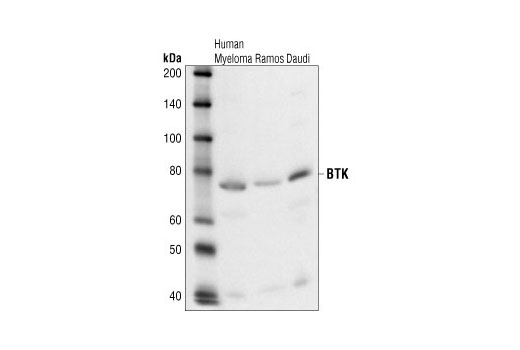 Western blot analysis of various cell lysates using BTK Antibody.