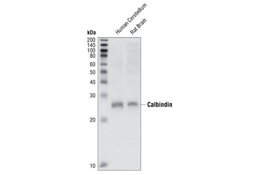 Western blot analysis of extracts from human cerebellum and rat brain using Calbindin Antibody.