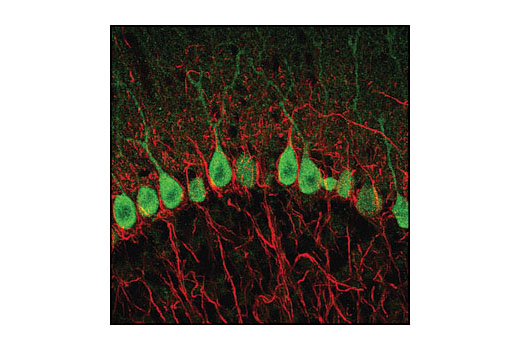 Confocal immunofluorescent image of mouse cerebellum labeled with Calbindin Antibody (green) and Neurofilament-L (DA2) Mouse mAb #2835 (red).