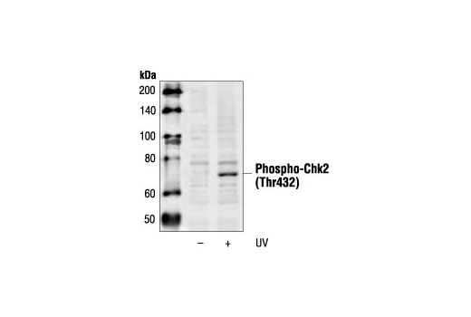 Western blot analysis of extracts from HeLa cells, untreated or UV-treated, using Phospho-Chk2 (Thr432) Antibody.