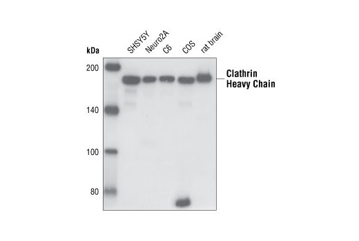 Western blot analysis of extracts from SHSY5Y, Neuro2A, C6, COS cells and rat brain lysate, using Clathrin Heavy Chain (I67) Antibody.