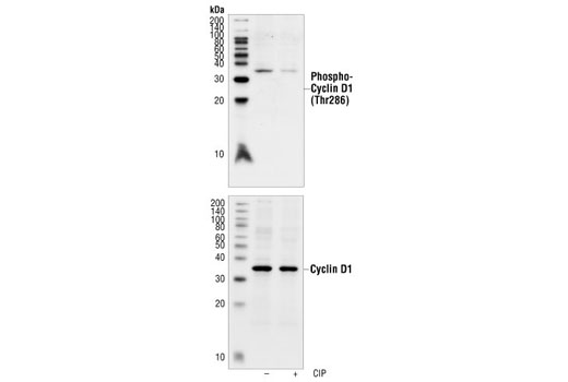 Western blot analysis of extracts from SK-N-MC cells, untreated or calf intestinal phosphatase (CIP)-treated, using Phospho-Cyclin D1 (Thr286) Antibody (upper) or Cyclin D1 Mouse mAb #2926 (lower).