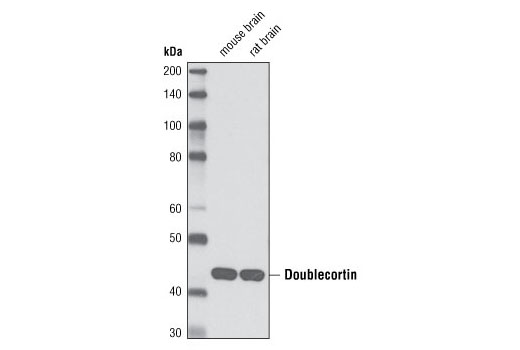 Western blot analysis of extracts from mouse and rat brain using Doublecortin (D7E4) Rabbit mAb.