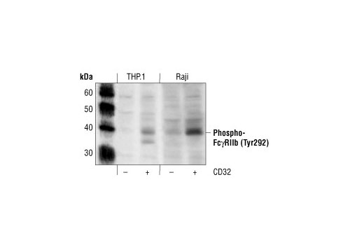 Western blot analysis of extracts from control or CD32 crosslinked human THP.1 or Raji cell lines, using Phospho-CD32 (FcgammaRIIb) (Tyr292) Antibody.