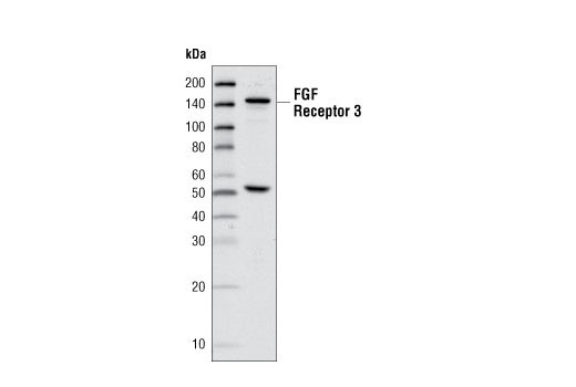 Western blot analysis of extracts from Kms-11 cell lysates using FGF Receptor 3 Antibody.