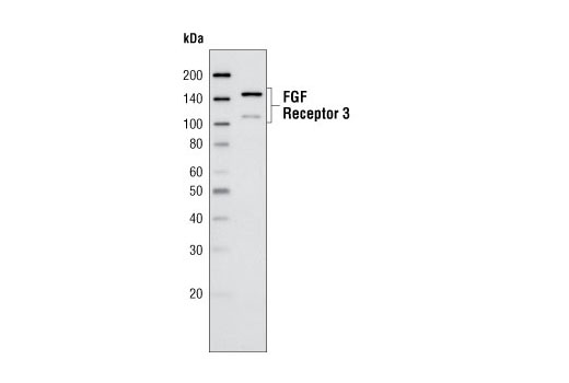 Western blot analysis of KMS-11 cell lysates using FGF Receptor 3 (D2G7E) Rabbit mAb.