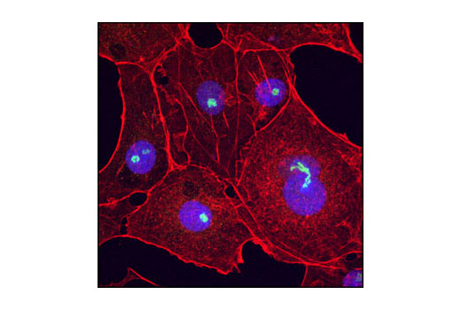 Confocal immunofluorescent analysis of COS cells using Fibrillarin (R122) Antibody (IF Specific) (green). Actin filaments have been labeled with Alexa Fluor ® 555 phalloidin (red). Blue pseudocolor = DRAQ5 ® #4084 (fluorescent DNA dye).