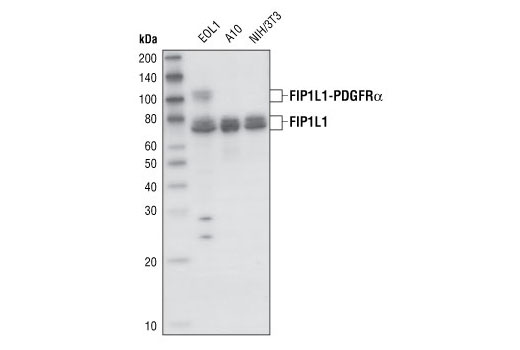 Western blot analysis of total cell lysates from EOL1, A10 and NIH/3T3 cells, using FIP1L1 Antibody.