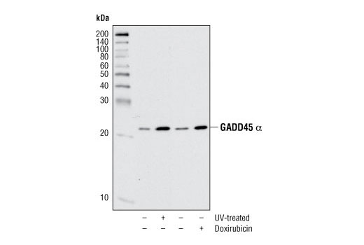 Western blot analysis of extracts of HeLa cells, untreated or treated with UV or doxirubicin, using GADD45 α Antibody.