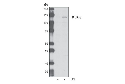 Western blot analysis of extracts from differentiated THP-1 cells, untreated (-) or treated with LPS (1 μg/ml, overnight), using MDA-5 (K375) Antibody.