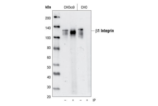 Immunoprecipitation of α9/β1 integrin from CHO cells transfected with human α9 integrin. Endogenous β1 integrin was detected by western blot using Integrin β1 Antibody #4706.