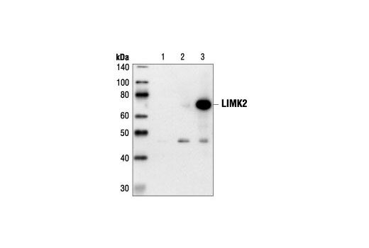 Western blot analysis of extracts from COS (lane 1), COS transfected with triple HA-tagged LIMK1 (lane 2) and COS transfected with LIMK2 (lane 3), using LIMK2 Antibody.