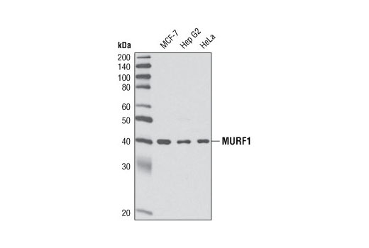 Western blot analysis of extracts from MCF-7, Hep G2 and HeLa cells using MURF1 Antibody.