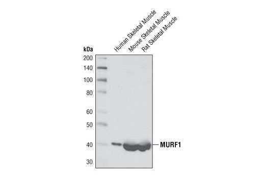 Western blot analysis of extracts from human, mouse and rat skeletal muscles using MURF1 Antibody.