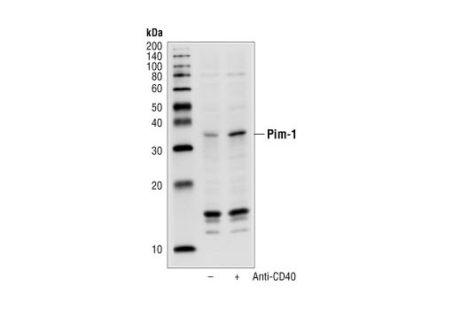 Western blot analysis of extracts from Raji cells, untreated or treated with anti-CD40 (30 min), using Phospho-Pim-1 (Tyr218) Antibody.