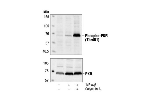 Western blot analysis of extracts from HeLa cells, untreated or IFN-alpha/beta-treated (1000 U/ml for 18 hours), and subsequently untreated or calyculin A-treated ( 0.1 µM for 15 minutes), using Phospho-PKR (Thr451) Antibody (upper) or PKR Antibody #3072 (lower).