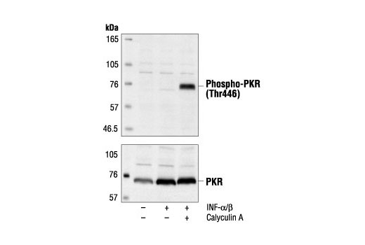 Western blot analysis of extracts from HeLa cells, untreated or INF-alpha/beta-treated (1000 U/ml for 18 hours), and subsequently untreated or calyculin A-treated ( 0.1 µM for 15 minutes), using Phospho-PKR (Thr446) Antibody (upper) or PKR Antibody #3072 (lower).