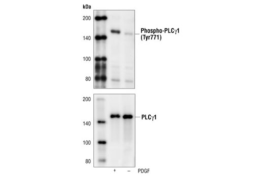 Western blot analysis of extracts from NIH/3T3 cells, untreated or PDGF-treated, using Phospho-PLCgamma1 (Tyr771) Antibody (upper) or PLCgamma1 Antibody #2822 (lower).