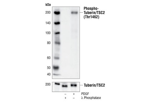 Western blot analysis of extracts from l phosphatase-treated or PDGF treated NIH/3T3 cells, using Phospho- Tuberin/TSC2 (Thr1462) (5B12) Rabbit mAb (upper) or Tuberin Antibody (lower).