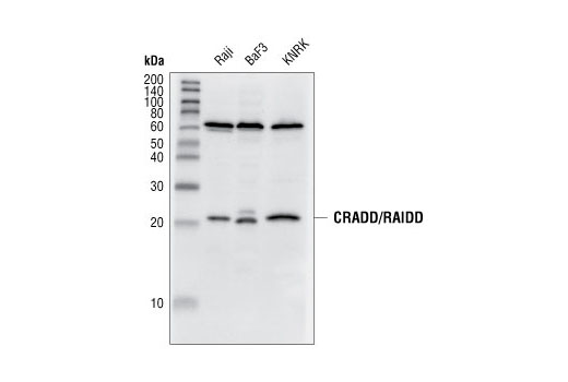 Western blot analysis of extracts from Raji (human), BaF3 (mouse) and KNRK (rat) cell lines, using CRADD/RAIDD Antibody.
