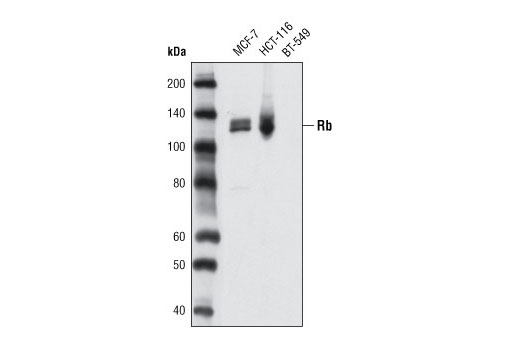 Western blot analysis of extracts from MCF-7, HCT-116 and BT-549 cells using Rb (D3D2) XP ® Rabbit mAb. BT-549 cells do not express Rb.