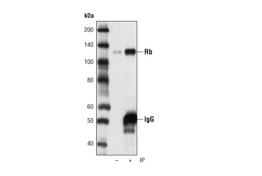 Rb was immunoprecipitated from Jurkat cell lysates using Rb (D3D2) XP ® Rabbit mAb. Western blot was performed using the same antibody. Lane 1 is 5% input.