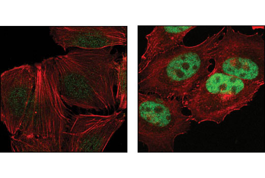 Confocal immunofluorescent analysis of MCF-7 cells (right) and Saos2 cells (left) using Rb (D3D2) XP ® Rabbit mAb (green). Actin filaments have been labeled with DY-554 phalloidin (red).