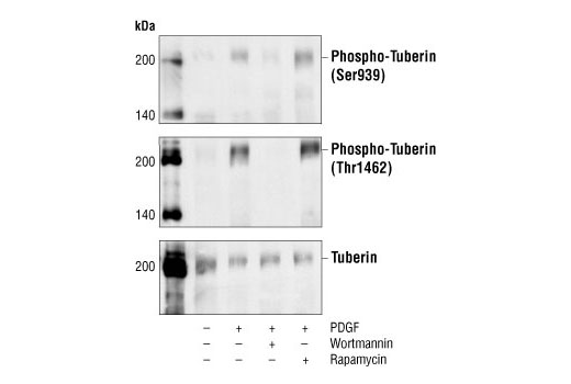 Western blot analysis of extracts from NIH/3T3 cells, untreated, PDGF-treated, and PDGF and wortmannin-treated or PDGF and rapamycin-treated, using Phospho-Tuberin/TSC2 (Ser939) Antibody (top), Phospho-Tuberin/TSC2 (Thr1462) Antibody #3611 (middle) or Tuberin/TSC2 Antibody #3612 (bottom).