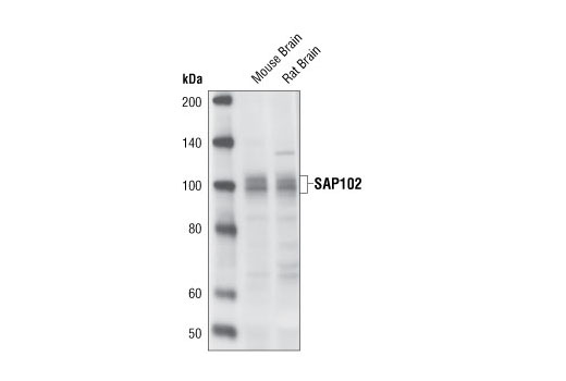 Western blot analysis of extracts from mouse and rat brain using SAP102 Antibody.