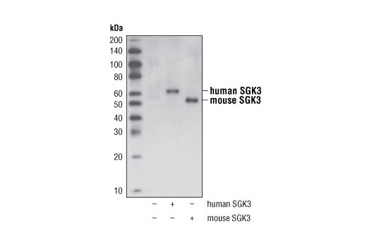 Western blot analysis of extracts from COS-7 cells, untransfected or transfected with human or mouse SGK3, using SGK3 Antibody.