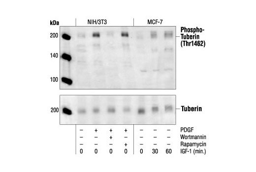 Western blot analysis of extracts from NIH/3T3 cells, untreated, PDGF-treated (50 ng/ml), PDGF and wortmannin-treated (200 nM) or PDGF and rapamycin-treated (5 nM), and MCF-7 cells, untreated or IGF-1 treated for the indicated times, using Phospho-Tuberin/TSC2 (Thr1462) Antibody (upper) or Tuberin/TSC2 Antibody #3612 (lower).