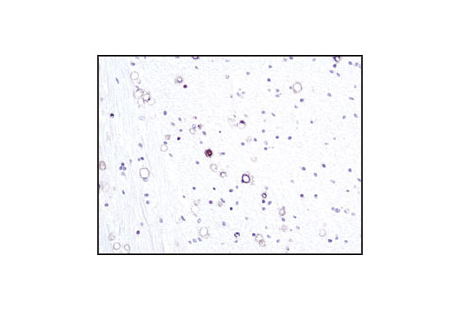 Immunohistochemical analysis of paraffin-embedded human Alzheimer brain, using Thimet Oligopeptidase (IVD6) Mouse mab.