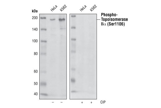 Western blot analysis of extracts from HeLa and K562 cells, using Phospho-Topoisomerase IIalpha (Ser1106) Antibody. The phospho-specificity of the antibody was verified by treating the membrane with (+) (right) or without (-) (left) calf intestinal phosphatase (CIP) after Western transfer.