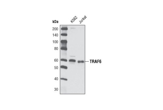 Western blot analysis of extracts from K562 and Jurkat cell lines using TRAF6 Antibody.