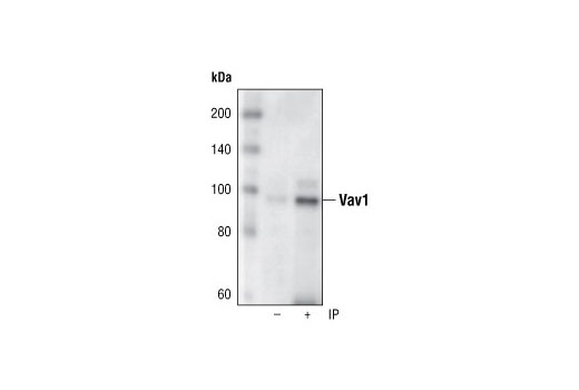 Immunoprecipitation of Vav1 from Jurkat cell lysates, using Vav1 (R775) Antibody. Western blot was performed using the same antibody.