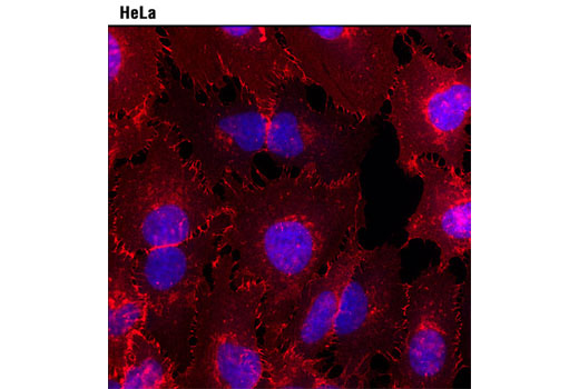 Immunofluorescent analysis of HeLa cells using β-Catenin (L54E2) Mouse mAb (IF Preferred) #2677 detected with Anti-mouse IgG (H+L), F(ab') 2 Fragment (Alexa Fluor ® 594 Conjugate) (red). Blue pseudocolor = DRAQ5 ® #4084 (fluorescent DNA dye).