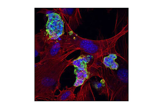 Confocal immunofluorescent analysis of mouse embryonic stem cells growing on mouse embryonic fibroblast (MEF) feeder cells using SSEA1 (MC480) Mouse mAb #4744 detected with anti-Mouse IgG (H+L), F(ab') 2 Fragment (Alexa Fluor ® 488 Conjugate) (green). Actin filaments have been labeled with DY-554 phalloidin (red). Blue pseudocolor = DRAQ5 ® #4084 (fluorescent DNA dye).