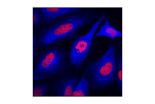 Confocal immunofluorescent analysis of HeLa cells using Pan-Keratin (C11) Mouse mAb #4545 detected with Anti-Mouse IgG (H+L), F(ab') 2 Fragment (Alexa Fluor ® 647 Conjugate) (blue). Red = propidium iodide (fluorescent DNA dye).