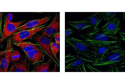 Confocal immunofluorescent analysis of HeLa cells labeled with MEK1/2 (47E6) Rabbit mAb #9126 detected with Anti-Rabbit IgG (H+L), F(ab') 2 Fragment (Alexa Fluor ® 555 Conjugate) (red, left) compared to an isotype control (right). Actin filaments have been labeled with fluorescein phalloidin (green). Blue pseudocolor = DRAQ5 ® #4084 (fluorescent DNA dye).
