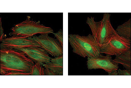 Confocal immunofluorescent analysis of HeLa cells, untreated (left) or heat shocked (right), using HSP70 (6B3) Rat mAb #4873 detected with Anti-rat IgG (H+L), (Alexa Fluor ® 488 Conjugate) (green). Actin filaments have been labeled with Alexa Fluor ® 555 phalloidin (red).