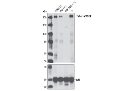 Western blot analysis of extracts from SH-SY5Y and C6 cells, and from wild-type (wt) and TSC2-deficient (-/-) mouse embryonic fibroblasts (MEF), using Tuberin/TSC2 (D57A9) Rabbit mAb (upper) and Akt (pan) (C67E7) Rabbit mAb #4691 (lower).