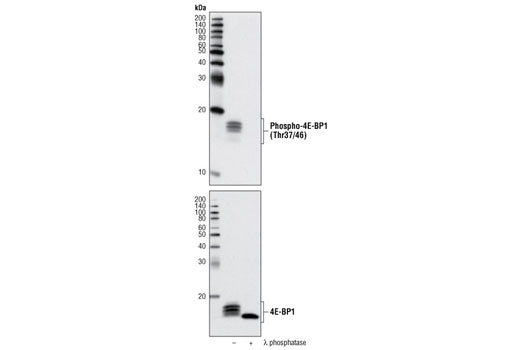 Western blot analysis of extracts from HeLa cells, serum-starved and stimulated with insulin (100 nM for 5 minutes), with (+) or without (-) λ phosphatase treatment, using Phospho-4E-BP1 (Thr37/46) (236B4) Rabbit mAb (Biotinylated) (upper) and 4E-BP1 (53H11) Rabbit mAb #9644 (lower).