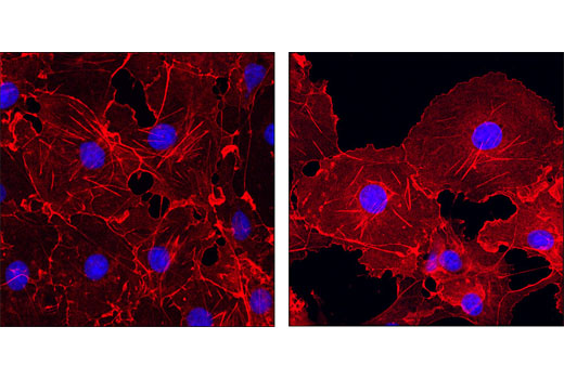 Confocal immunofluorescent analysis of COS-7 cells, at high confluency (left) or low confluency (right), using β-Actin (13E5) Rabbit mAb (Alexa Fluor ® 555 Conjugate) (red). Blue pseudocolor = DRAQ5 ® #4084 (fluorescent DNA dye).