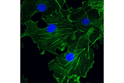 Confocal immunofluorescent analysis of COS-7 cells using β-Actin (13E5) Rabbit mAb (Alexa Fluor ® 488 Conjugate) (green). Blue pseudocolor = DRAQ5 ® #4084 (fluorescent DNA dye).